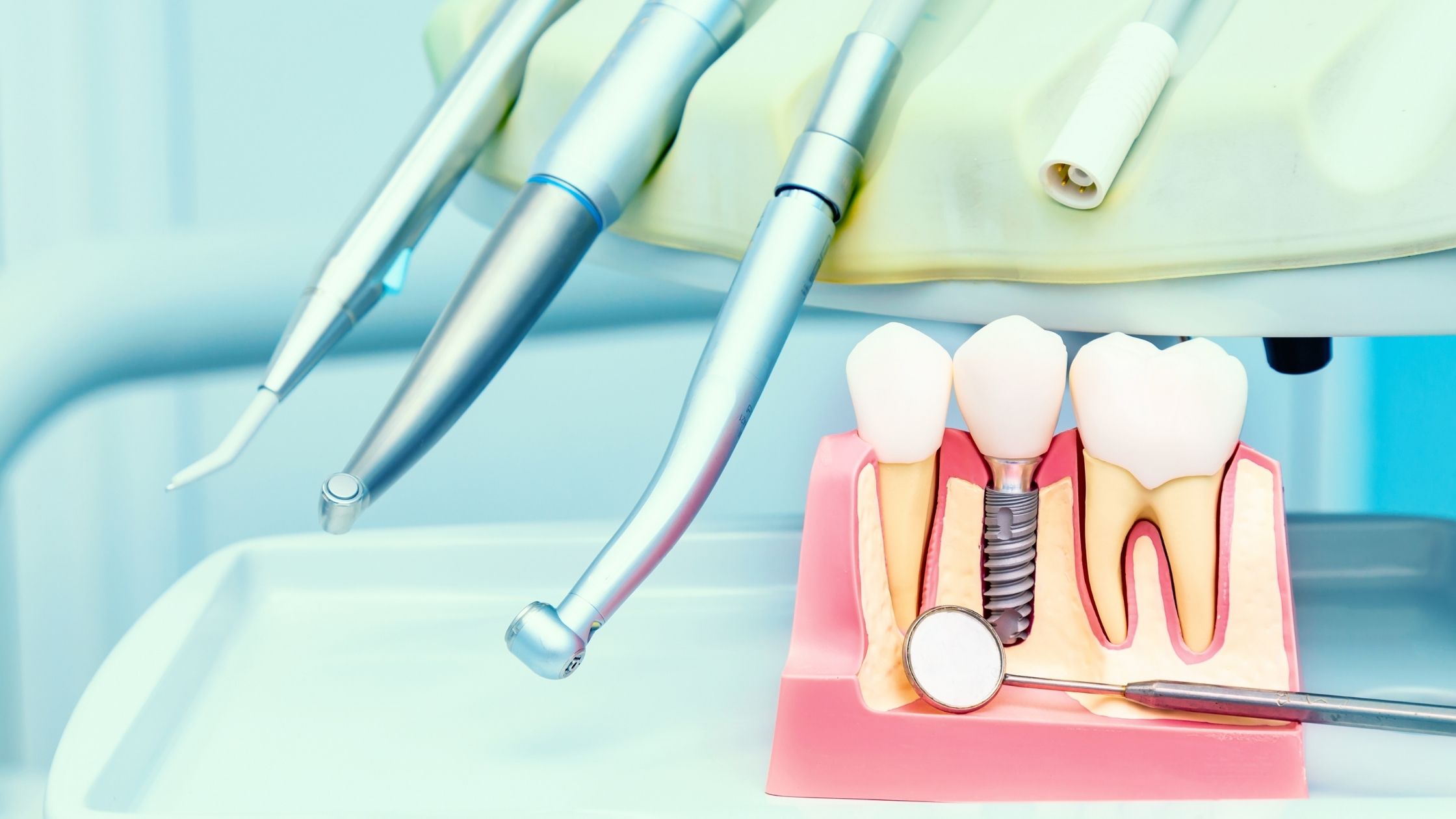 Preparing For Dental Implants: What You Need To Know