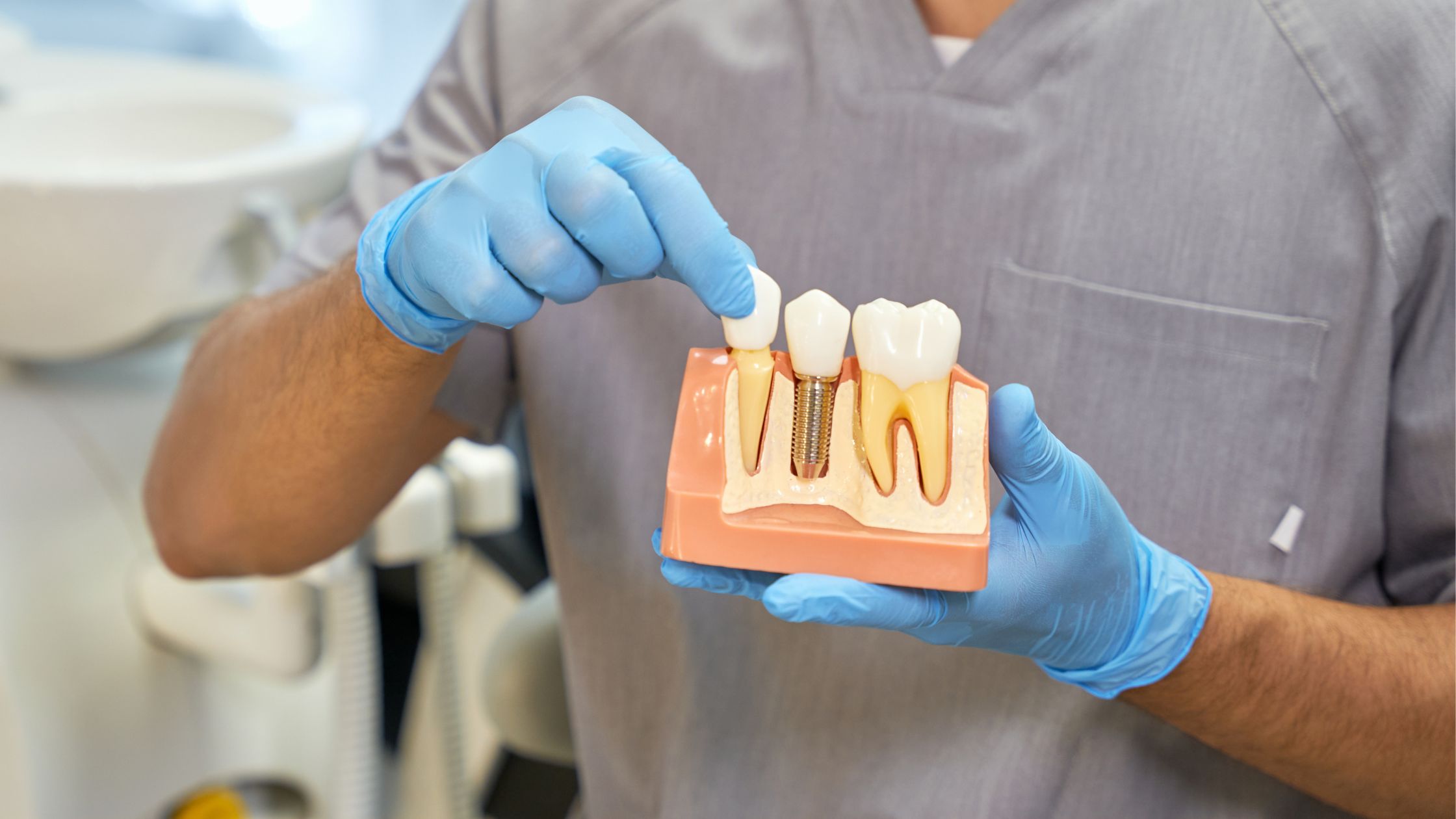 What are Dental Implants and How Do They Work?