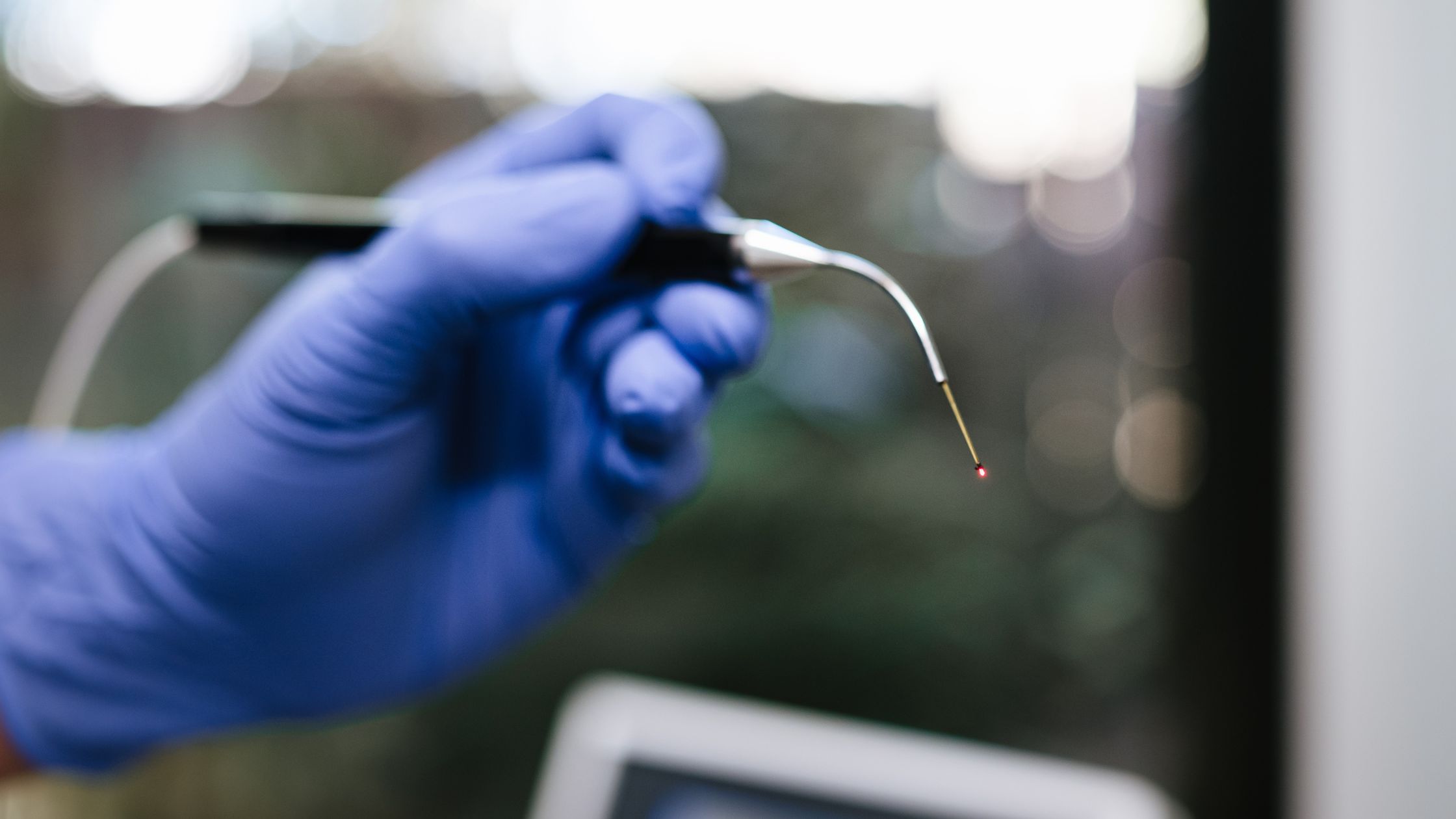 Laser Gum Surgery in Ormond Beach: Your Top Questions Answered